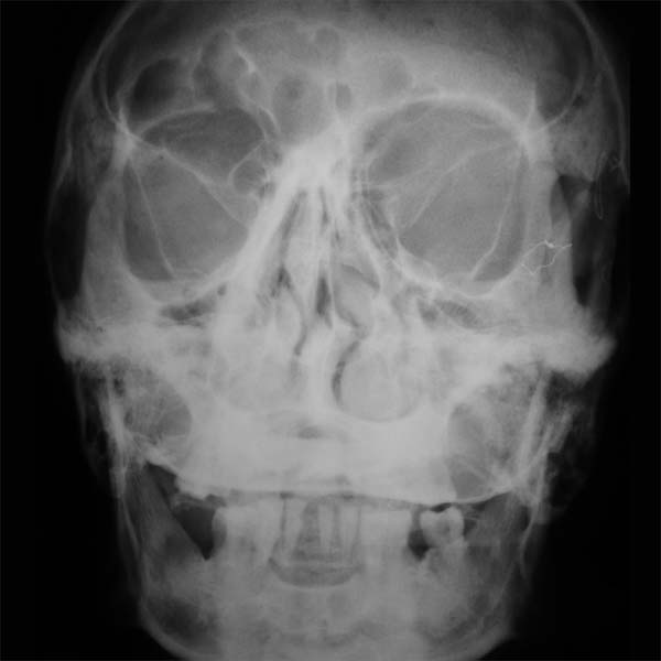 Khola Cosmica - Khola Cosmica (Vinyl) - Joco Records