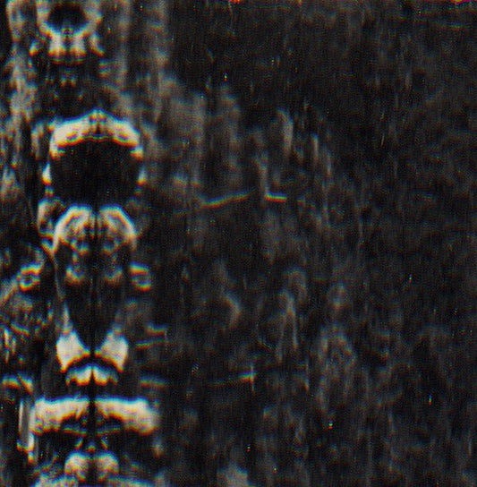 O Morto - The Forest, The People And The Spirits (LP) - Joco Records