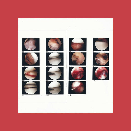 The Cradle - Laughing In My Sleep (LP) - Joco Records
